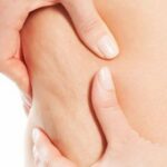 Integratori contro la cellulite 1