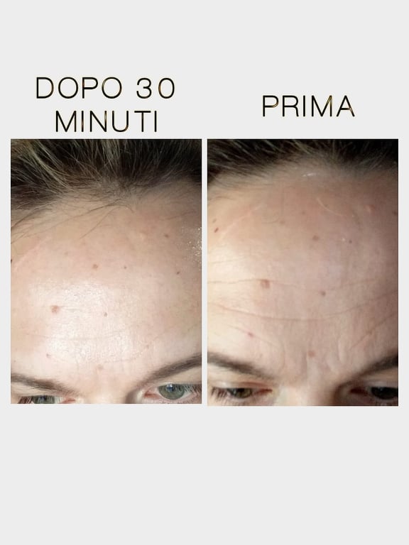 prima e dopo 2